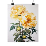 Yellow Peony Flowers Poster, Yellow Flower Art Print, Floral Artwork 15 Peony