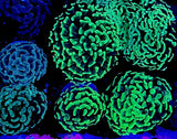 Australian Branch Hammer Corals- Pot Luck- Live Coral Healthy Single Heads Anemone