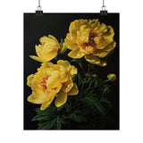 Yellow Peony Flowers Poster, Yellow Flower Art Print, Floral Artwork 17 Peony